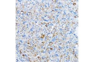 Immunohistochemistry of paraffin-embedded rat ovary using Aromatase (CYP19) antibody (2684) at dilution of 1:100 (40x lens). (Aromatase Antikörper  (AA 1-180))