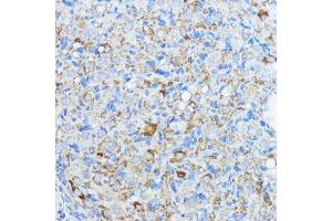 Immunohistochemistry of paraffin-embedded rat ovary using Aromatase (CYP19) antibody (2684) at dilution of 1:100 (40x lens).