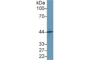 Detection of SYTL2 in Mouse Cerebrum lysate using Polyclonal Antibody to Synaptotagmin Like Protein 2 (SYTL2) (SYTL2 Antikörper  (AA 329-880))