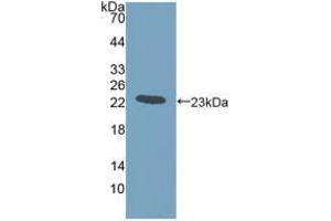 Western blot analysis of recombinant Human GREM1. (GREM1 Antikörper  (AA 26-184))