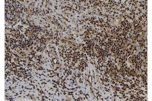 ABIN6273425 at 1/100 staining Human spleen tissue by IHC-P. (ATRAID Antikörper  (Internal Region))