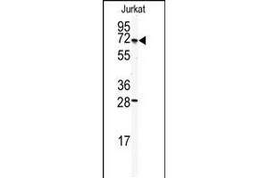Western blot analysis of anti-CETP Antibody in Jurkat cell line lysates (35ug/lane).