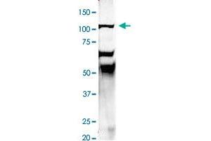 Immunoprecipitation of rat brain homogenate with EEA1 polyclonal antibody  at 1:500 dilution. (EEA1 Antikörper  (N-Term))