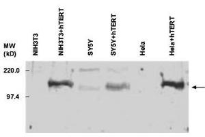 TERT anticorps  (C-Term)