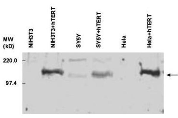 TERT antibody  (C-Term)