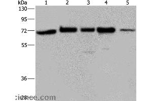 Western blot analysis of A172, Hela and 293T cell, K562 cell and human testis tissue, using AGFG1 Polyclonal Antibody at dilution of 1:727 (AGFG1 Antikörper)