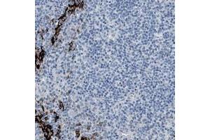 Immunohistochemical staining of human tonsil with FDCSP polyclonal antibody  shows strong cytoplasmic positivity in squamous epithelial cells at 1:50-1:200 dilution. (FDCSP Antikörper)