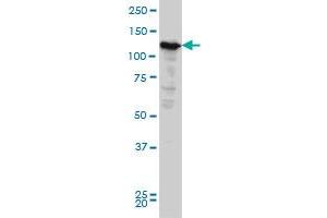 NOPE monoclonal antibody (M03), clone 6E6 Western Blot analysis of NOPE expression in HeLa . (IGDCC4 Antikörper  (AA 1152-1250))