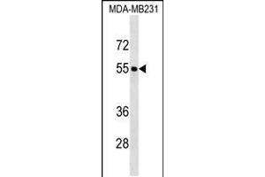 Western blot analysis in MDA-MB231 cell line lysates (35ug/lane). (FOXQ1 Antikörper  (AA 263-292))