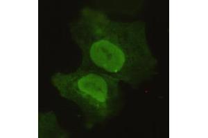 Immunocytochemistry of COS7 cells using anti-Sox2 mouse mAb diluted 1:150. (SOX2 Antikörper)