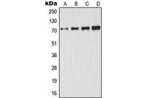 Western blot analysis of GCLC expression in HeLa (A), A431 (B), Jurkat (C), HepG2 (D) whole cell lysates. (GCLC Antikörper  (Center))