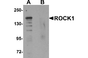 Western blot analysis of ROCK1 in 293 cell lysate with ROCK1 antibody at 1 µg/mL in (A) the absence and (B) the presence of blocking peptide. (ROCK1 Antikörper  (N-Term))