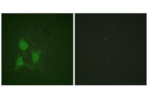 Immunofluorescence (IF) image for anti-PKA alpha/beta Cat (pThr197) antibody (ABIN1847296) (PKA alpha/beta Cat (pThr197) Antikörper)