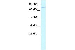 Human HepG2; WB Suggested Anti-ZNF336 Antibody Titration: 0. (ZNF336 Antikörper  (N-Term))
