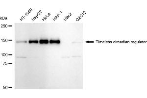 Western blotting analysis using Timeless circadian regulator antibody (ABIN7800558). (Rekombinanter TIMELESS Antikörper)