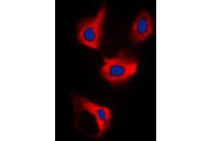 Immunofluorescent analysis of CDCA3 staining in MCF7 cells. (CDCA3 Antikörper  (C-Term))