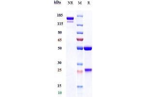 Anti-CSF1R / M-CSFR / CD115 Reference Antibody (cabiralizumab) on SDS-PAGE under reducing (R) condition. (Rekombinanter CSF1R (Cabiralizumab Biosimilar) Antikörper)