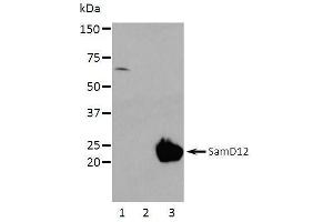 Western Blotting (WB) image for anti-Sterile alpha Motif Domain Containing 12 (SAMD12) (full length) antibody (ABIN2443898) (SAMD12 Antikörper  (full length))