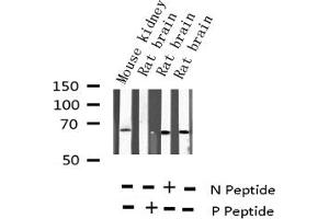Western blot analysis of Phospho-NF kappaB p65 (Thr435) expression in various lysates (NF-kB p65 Antikörper  (pThr435))