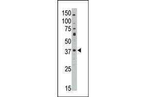 The anti-GEA10 C-term Antibody (ABIN390102 and ABIN2840614) is used in Western blot to detect GEA10 in HL60 lysate. (MAGEA10 Antikörper  (C-Term))