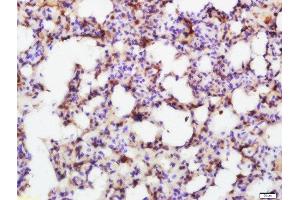 Immunohistochemistry (Paraffin-embedded Sections) (IHC (p)) image for anti-SMAD, Mothers Against DPP Homolog 7 (SMAD7) (AA 1-100) antibody (ABIN670206)