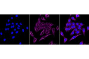 Immunocytochemical staining of HepG2 cells with Lumican antibody (ABIN7799286), 1:1,000).