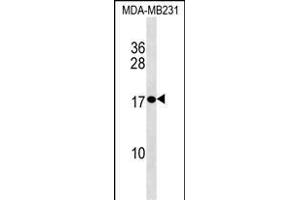 PLAC1 Antibody (C-term) (ABIN1536674 and ABIN2838318) western blot analysis in MDA-M cell line lysates (35 μg/lane). (PLAC1 Antikörper  (C-Term))