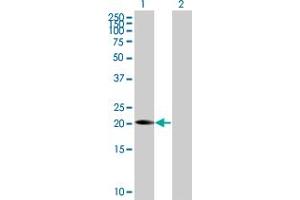 Lane 1: FGF19 transfected lysate ( 24 KDa) Lane 2: Non-transfected lysate. (FGF19 293T Cell Transient Overexpression Lysate(Denatured))