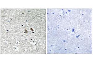 Immunohistochemistry analysis of paraffin-embedded human brain tissue using IRAK1 (Phospho-Ser376) antibody. (IRAK1 Antikörper  (pSer376))