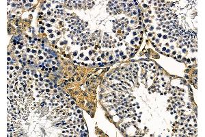 ABIN6263526 and ABIN6279596 at 1/100 staining mouse testis tissue by IHC-P. (NBPF3 Antikörper  (Internal Region))