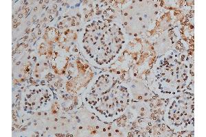 ABIN6255746 and ABIN6268991 at 1/200 staining human kidney tissue sections by IHC-P. (PPP1R12A Antikörper  (pThr853))