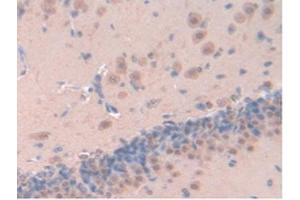 IHC-P analysis of Rat Brain Tissue, with DAB staining. (Leptin Antikörper  (AA 22-167))