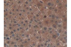 Immunohistochemistry (IHC) image for anti-Glutathione Peroxidase 4 (GPX4) (AA 74-197) antibody (ABIN7438652)