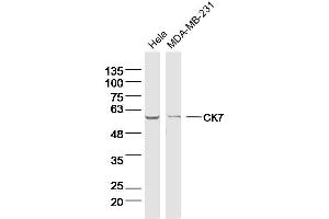 Lane 1: Hela lysates Lane 2: MDA-MB-231 lysates probed with CK7 Polyclonal Antibody, Unconjugated  at 1:300 dilution and 4˚C overnight incubation. (Cytokeratin 7 Antikörper)
