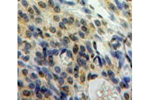 Used in DAB staining on fromalin fixed paraffin-embedded Ovary tissue (HMGN1 Antikörper  (AA 14-100))