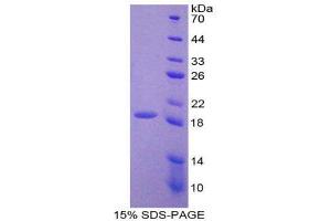 SDS-PAGE (SDS) image for Lysyl Oxidase-Like 4 (LOXL4) (AA 399-552) protein (His tag) (ABIN1170903) (LOXL4 Protein (AA 399-552) (His tag))