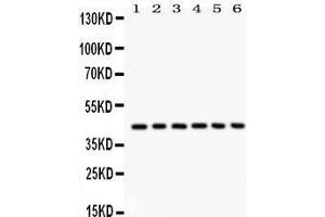 Western Blotting (WB) image for anti-Selectin L (SELL) (AA 39-372) antibody (ABIN3043326) (L-Selectin Antikörper  (AA 39-372))