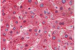 Immunohistochemistry (Formalin-fixed Paraffin-embedded Sections) (IHC (fp)) image for anti-Serpin Peptidase Inhibitor, Clade G (C1 Inhibitor), Member 1 (SERPING1) antibody (ABIN574166)