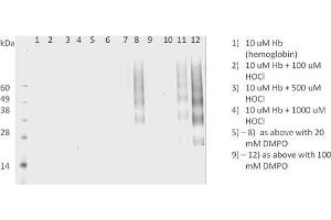 Western Blot analysis of Human HL 60 clone 15 eosinophils lysates showing detection of DMPO protein using Mouse Anti-DMPO Monoclonal Antibody, Clone N1664A (ABIN2482182).