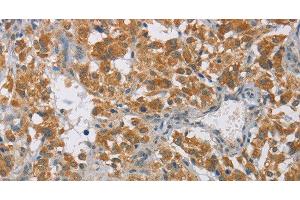 Immunohistochemistry (Paraffin-embedded Sections) (IHC (p)) image for anti-Deiodinase, Iodothyronine, Type I (DIO1) antibody (ABIN7236774)