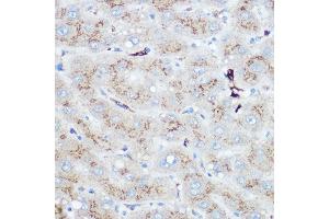 Immunohistochemistry of paraffin-embedded human liver using Heme Oxygenase 1 (HO-1/HMOX1) Rabbit pAb (ABIN3021906, ABIN3021907, ABIN3021908 and ABIN6217466) at dilution of 1:100 (40x lens). (HMOX1 Antikörper  (AA 1-288))