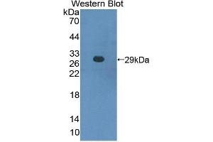 Detection of Recombinant CBFb, Mouse using Polyclonal Antibody to Core Binding Factor Beta Subunit (CBFb) (CBFB Antikörper  (AA 1-187))