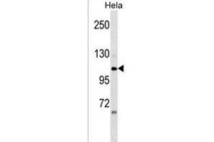 ZNF33A Antibody (N-term) (ABIN1539574 and ABIN2849907) western blot analysis in Hela cell line lysates (35 μg/lane).