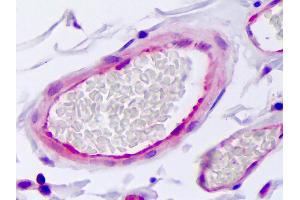 Anti-SERPINE1 / PAI-1 antibody IHC of human vascular endothelium. (PAI1 Antikörper)