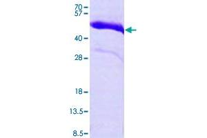 Image no. 1 for Cardiac Troponin T (cTnT) (AA 1-285) protein (His tag) (ABIN5570448) (Cardiac Troponin T2 Protein (AA 1-285) (His tag))