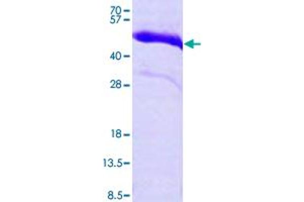 Cardiac Troponin T2 Protein (AA 1-285) (His tag)