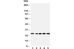 Western blot testing of SNRPN antibody and Lane 1:  rat kidney;  2: human U87;  3: (h) HeLa;  4: (h) HMY;  5: (m) NEUR cell lysate (SNRPN Antikörper  (N-Term))