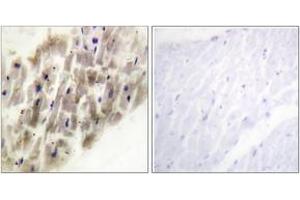 Immunohistochemistry analysis of paraffin-embedded human heart, using MAPKAPK-2 (Phospho-Thr222) Antibody.