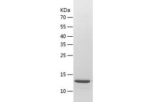 Western Blotting (WB) image for Intraflagellar Transport 20 Homolog (IFT20) (AA 1-132) protein (His tag) (ABIN7123632) (IFT20 Protein (AA 1-132) (His tag))