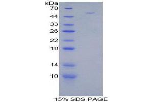 SDS-PAGE (SDS) image for Stanniocalcin 1 (STC1) (AA 28-247) protein (His tag,GST tag) (ABIN1880005)